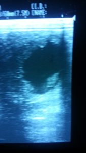 ultrasound-576x1024